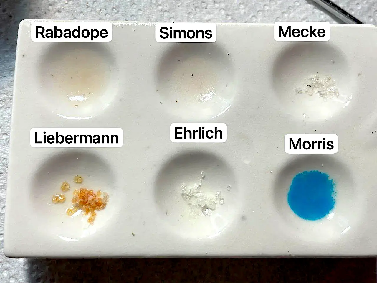 Vals-positieve cocaïne-testuitslagen