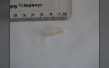 Galenika Rivotril-pillen (Clonazepam)