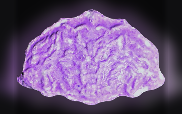 Shell-pillen (Ecstasy / MDMA)