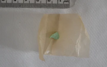 Klein groen pilfragment op papier naast een liniaal